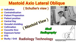 Mastoid Axio Lateral Oblique view  Schullers View in Hindi  Mastoid View [upl. by Butta880]