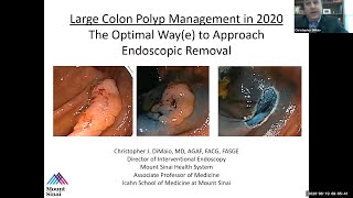 Large Colon Polyp Management in 2020 The Optimal Waye to Approach Endoscopic Removal [upl. by Germin689]