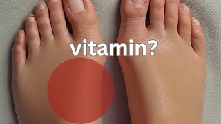 1 Vitamin to Say Goodbye to Swollen Feet and Legs [upl. by Enail]