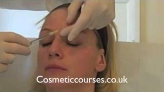 Botox training 3 Botox injection demonstration  Cosmetic Courses [upl. by Otrebide]