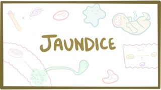 Jaundice  causes treatment amp pathology [upl. by Woodie]