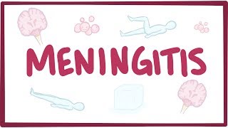 Meningitis  causes symptoms diagnosis treatment pathology [upl. by Mcnutt]