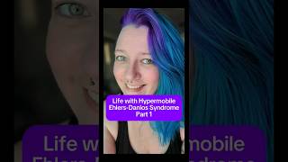 Life with Hypermobile EhlersDanlos Syndrome 1 chronicillness disability ehlersdanlos shorts [upl. by Udele106]