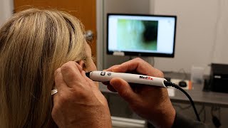 MedRx Video Otoscope Benefits [upl. by Aelak]