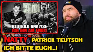 Der BEWEIS Patrick Teutsch STOFFT [upl. by Voletta18]