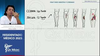 RM 2023 Traumatología 5 Fracturas Generalidades [upl. by Yelnoc]