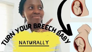 How To Turn Your Breech Baby Naturally [upl. by Erdried900]