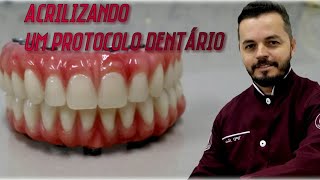 Acrilização de um protocolo dentário  mandíbular [upl. by Carlynn]