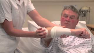 Pressure Ulcer Prevention ADERMA◊ Dermal Pad Elbow Application [upl. by Jordanson972]