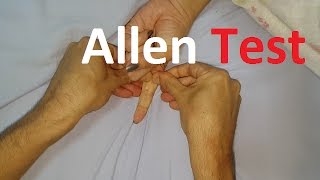 Allen´s Test  Radial vs Ulnar arteries [upl. by Beatrisa]