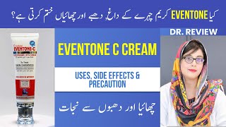 Eventone c cream  How To Use Side Effects In Detail  Dr Review [upl. by Ennis]