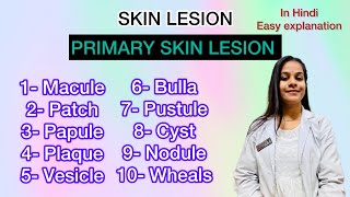 primary skin lesions lecture in Hindi with easy explanation [upl. by Ellis]