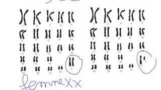 Caryotype  les bases [upl. by Assiral]