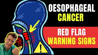 Warning signs amp symptoms of OESOPHAGEALAKA esophageal gullet CANCER  Doctor ODonovan explains [upl. by Yentrok]