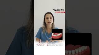 Dentadura Fixa ou Prótese Tipo Protocolo odonto odontologia dentadurafixa [upl. by Anaic582]