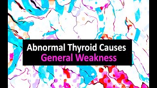 Abnormal Thyroid Causes General Weakness [upl. by Hcone]