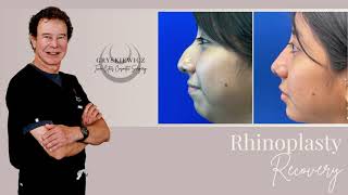 Learn about Rhinoplasty Recovery with Dr Joe [upl. by Lokcin495]