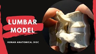 Lumbar Spine Anatomy Model  with Ligamentum Flavum and Interspinous Ligament [upl. by Ennagem15]