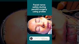 Here’s how I preserve facial nerve function during a parotidectomy parotidgland [upl. by Thirzi]