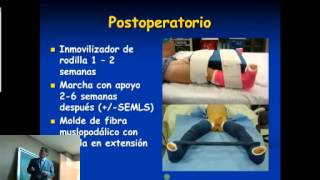 Manejo Ortopédico del paciente ambulatorio con PCI extremidades inferiores [upl. by Ramas411]