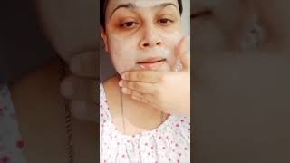 himalayafacewashvitamincfacewashskincareshortytshortyoutubershort vairalshortvideohorthshort [upl. by Kelwen]