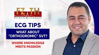 ECG Tip 25 Orthodromic SVT with WPW animated [upl. by Hastings]