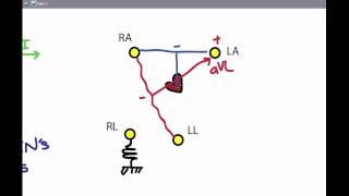 EKG 02 Electrodes and Leads [upl. by Eves932]