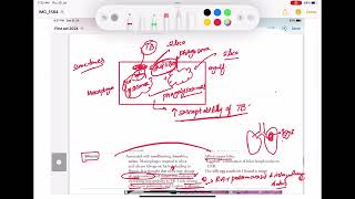 Pneumoconiosis Asbestosis Silicosis Berylliosis coal work Respiratory 42 First Aid USMLE Step1 [upl. by Im540]