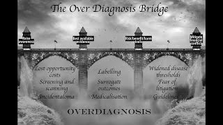 Bridge Over Diagnosis  a parody of Bridge Over Troubled Water [upl. by Hoyt]