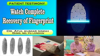 How to recover fingerprints  Fingerprint problem  Fingerprint problem solution  Fingerprints [upl. by Abel]