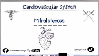 Mitral Stenosis  Murmurs  Cardiovascular system  Urdu Hindi [upl. by Drus]