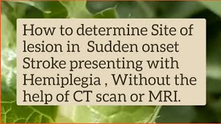 Stroke Localization in Hemiplegia  No CT Scan No MRI Help [upl. by Eceertal93]