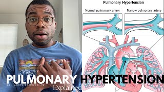 Pulmonary Hypertension Explained [upl. by Anyrb370]