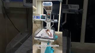 Umbilical line insertion hospital trending hospitaldoctor doctor hospitalist doctorshospital [upl. by Nhguavoj]