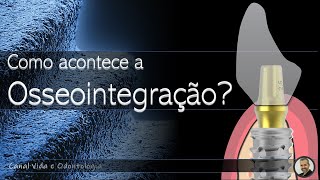 O Extraordinário FENÔMENO da Osseointegração explicado Célula por Célula implantesdentarios [upl. by Noroj]