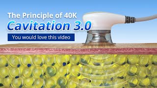 The Principle Of 40K Cavitation 30 The Most Advanced Technology Ever CAVITATION WEIGHTLOSS [upl. by Puklich649]