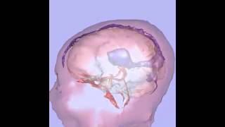 MRI of fetal brain [upl. by Odlanyer]