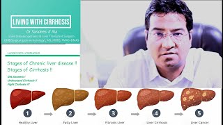 Stages of Chronic Liver Disease or Cirrhosis [upl. by Malita]