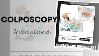 What is colposcopy  The diagnostic procedure Colposcope  Indication of colposcopy in tamil [upl. by Beacham]