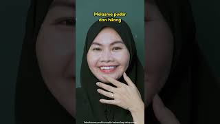 Serum membantu mencerahkan melasma dan jeragat  Abera Melasma Serum [upl. by Hardi]