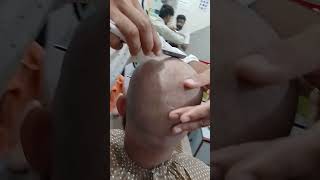 Dry skin Head shave dandruff removal 😱🔥🤣💈dandruff vs dry skinremove dandruff from hair [upl. by Islehc]