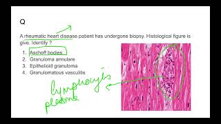 Neural Control and Coordination for NEET  Part 13  Myelinated Vs Nonmyelinated Nerve [upl. by Larred400]