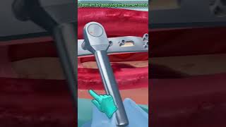 I am doctor gameplay video for repair broker bonus patient shorts shortsfeed [upl. by Grail]