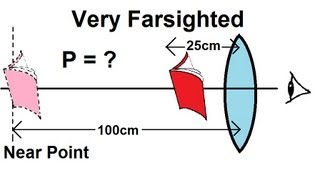 Physics  Optics Vision Correction 5 of 5 Very Farsighted [upl. by Ekaterina322]