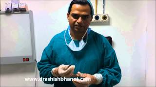 ADRENAL CORTICAL TUMOR DR ASHISH BHANOT [upl. by Elolcin840]