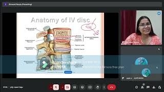 Prolapsed Intervertebral Disc Anatomy of IV Disc [upl. by Onibla]