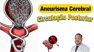 Aneurisma Cerebral Circulação posterior Como posso descobrir se eu tenho aneurisma [upl. by Nevs]