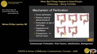 Colonoscopic perforation Risk factors identification management [upl. by Nayb]