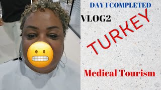 TURKEY TEETH  DAY 1 Completed  VLOG 2 [upl. by Ezzo]