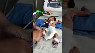 Very low birth weight baby newborn lowbirthweight cutebaby [upl. by Batish]